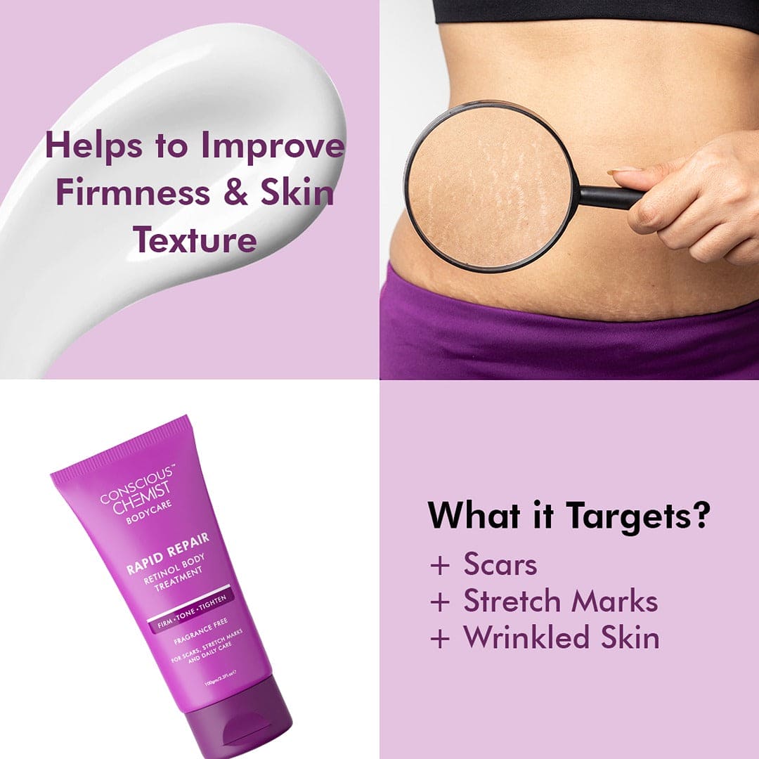 Resurfacing Body Cream | Treats Stretch Marks, Fine Lines & Wrinkles | 100 ml